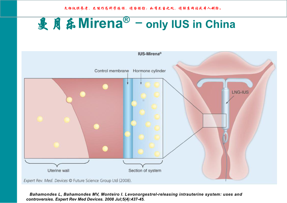 左炔诺孕酮宫内缓释系统在子宫内膜相关妇科疾病中的课件.ppt_第2页