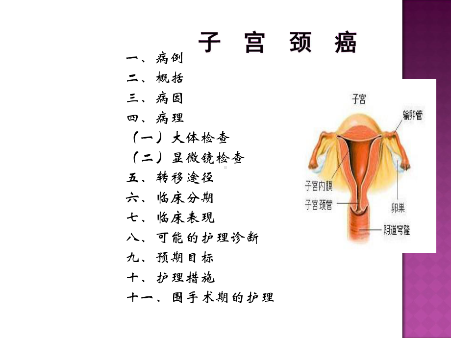 子宫颈癌的护理查房PPT课件1.ppt_第2页