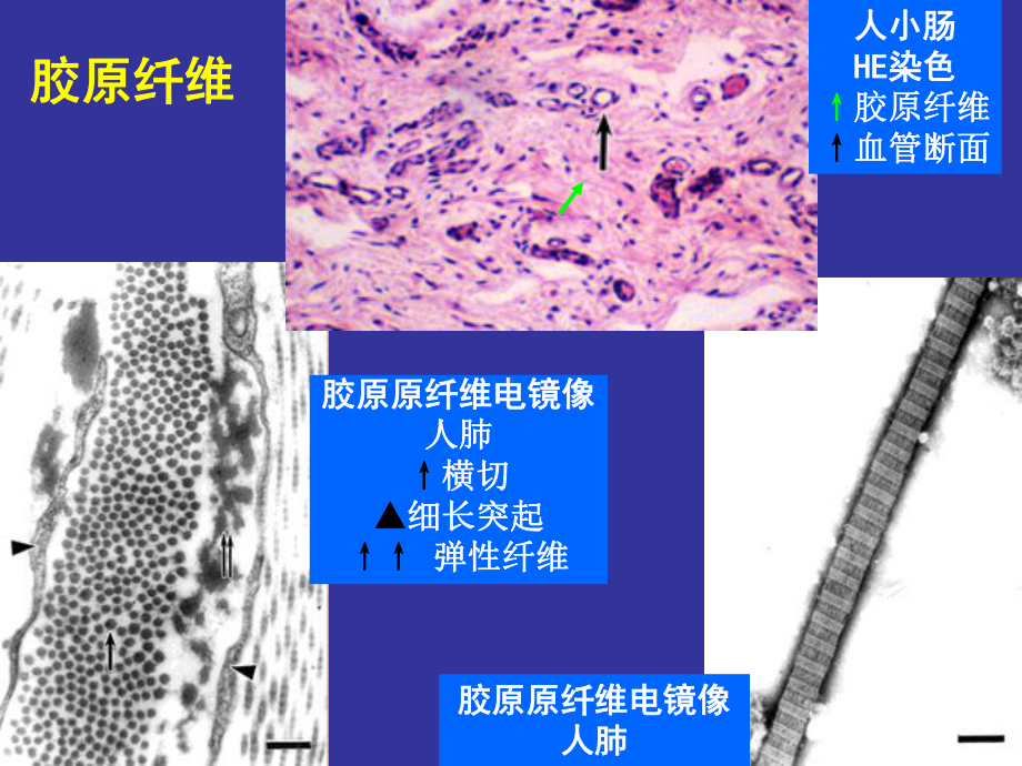 上海交通大学医学院组织胚胎学课件第三章 结缔组织.ppt_第3页