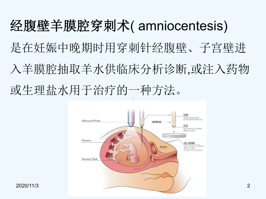 妇产科常用小手术课件.ppt_第2页