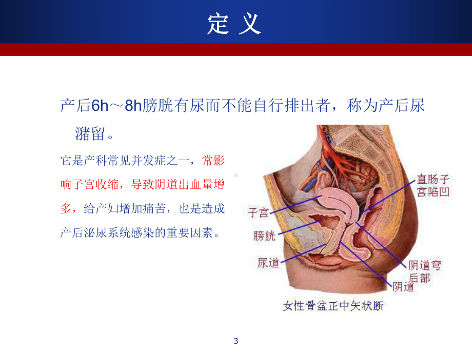 产后尿潴留护理PPT课件.ppt_第3页