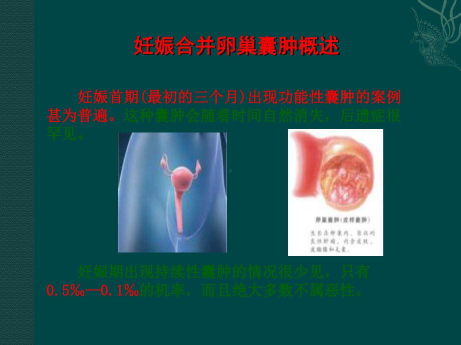 妊娠合并卵巢囊肿PPT课件.ppt_第3页