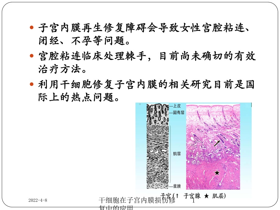 干细胞在子宫内膜损伤修复中的应用课件.ppt_第1页