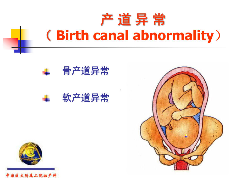 产道异常和产后出血-妇产科学精品课件.ppt_第3页