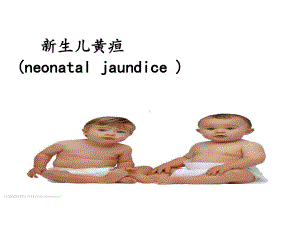 新生儿黄疸护理.ppt课件.ppt