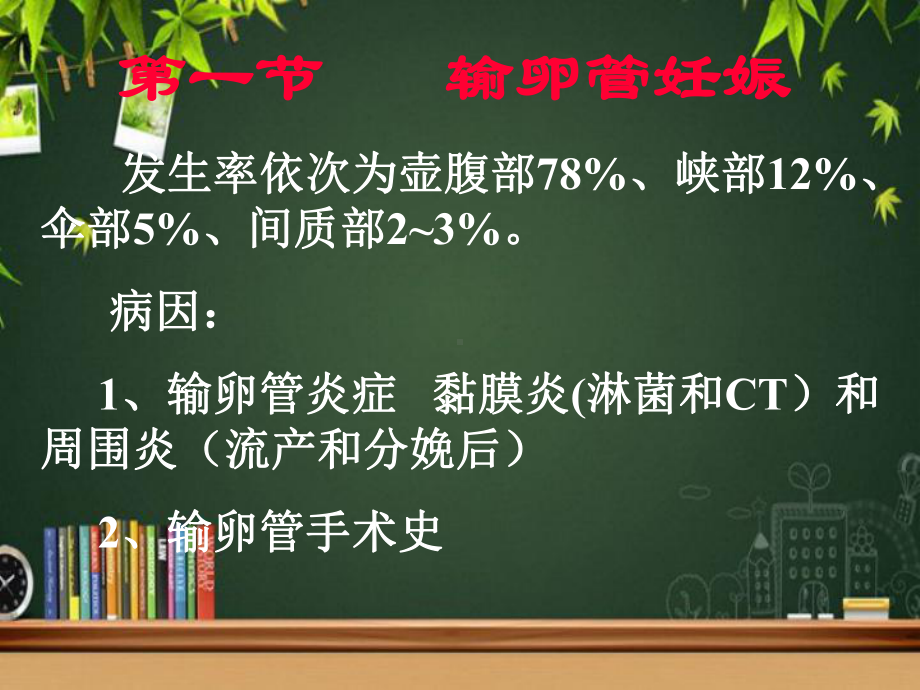 异位妊娠-PPT课件.ppt_第2页