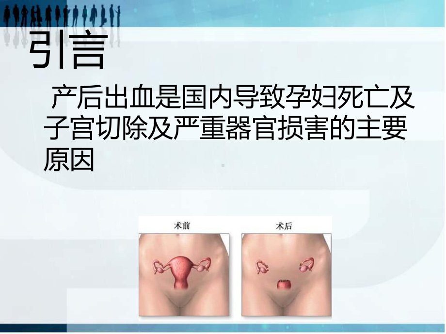 子宫切除之个案护理PPT课件.ppt_第2页