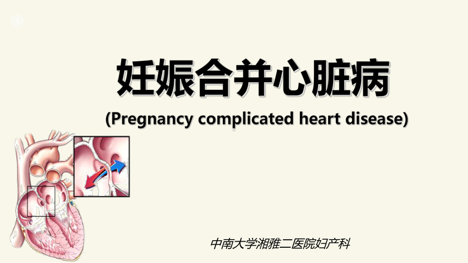 妊娠合并心脏病PPT课件.ppt_第1页