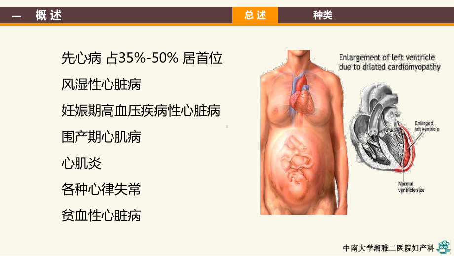 妊娠合并心脏病PPT课件.ppt_第3页