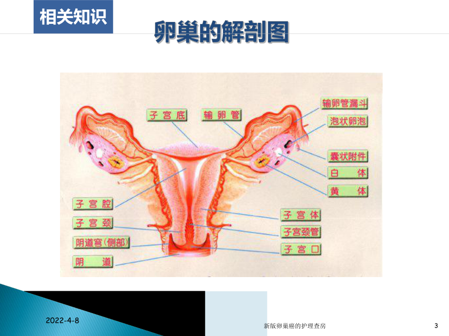 新版卵巢癌的护理查房培训课件.ppt_第3页