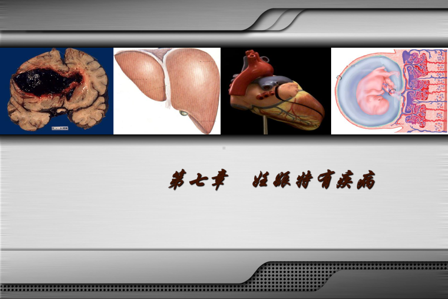 妊娠期糖尿病PPT课件.ppt_第3页