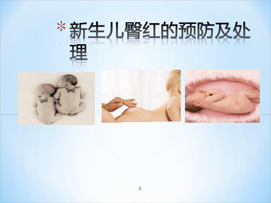 新生儿臀红的预防及护理PPT课件.ppt_第1页