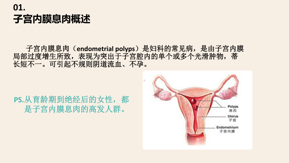 子宫内膜息肉护理-ppt课件.ppt_第3页