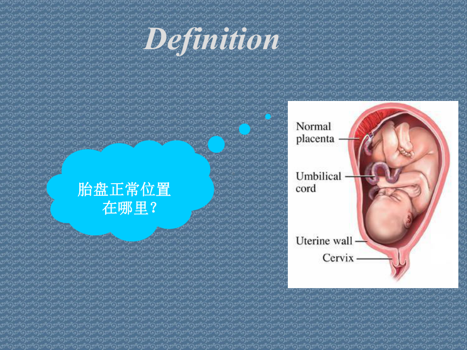 前置胎盘的概念、诊断、预防和处理课件.ppt_第3页