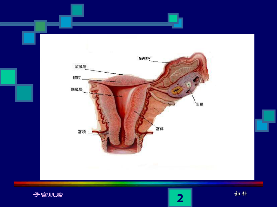 子宫肌瘤ppt课件.ppt_第2页