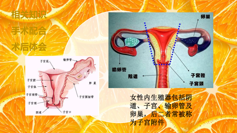 经腹全子宫切除术的手术配合-ppt课件.ppt_第2页