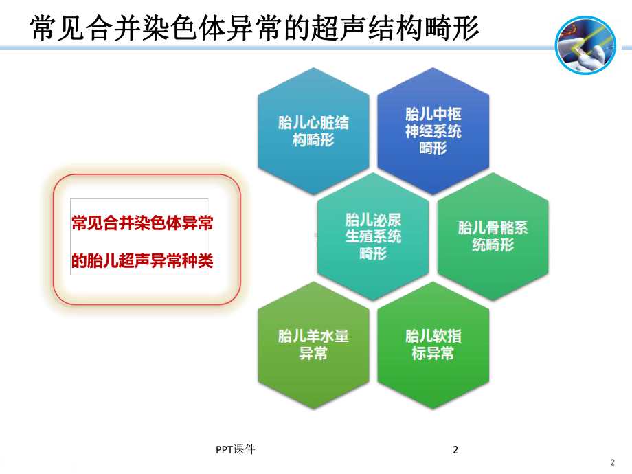 胎儿超声结构异常的遗传学诊断-ppt课件.ppt_第2页