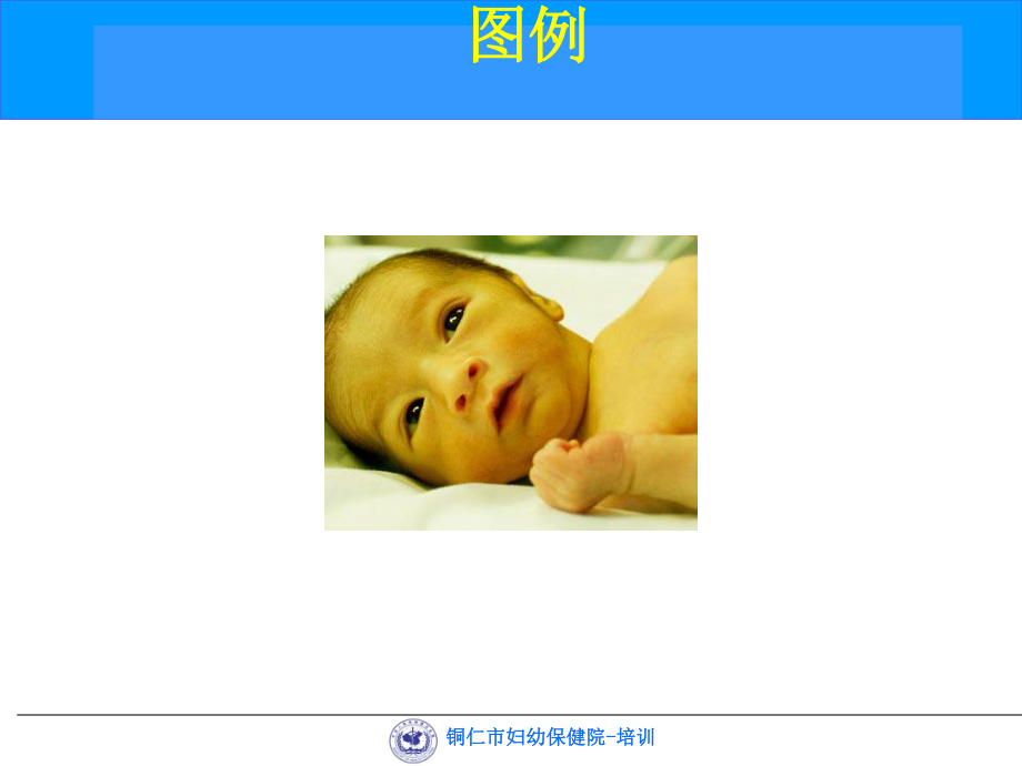 母子健康综合项目培训新生儿黄疸 ppt课件.ppt_第1页