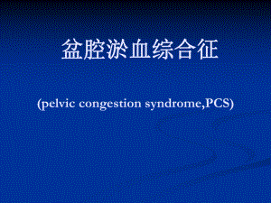 盆腔淤血综合征课件.ppt