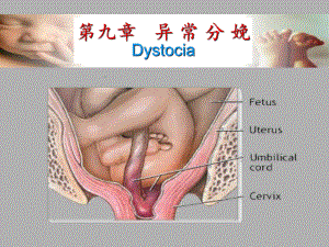 第九章-异常分娩PPT课件.ppt