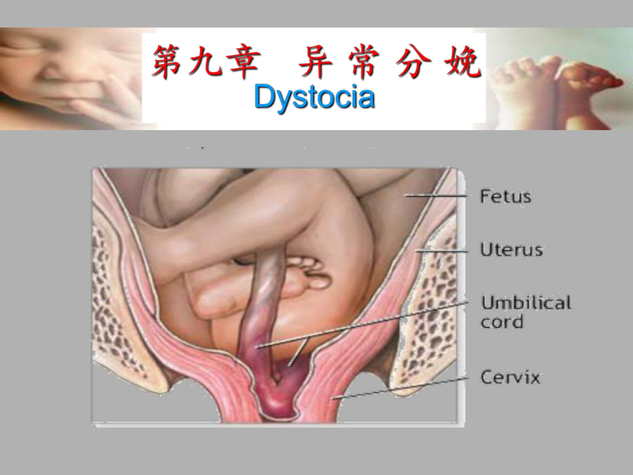 第九章-异常分娩PPT课件.ppt_第1页