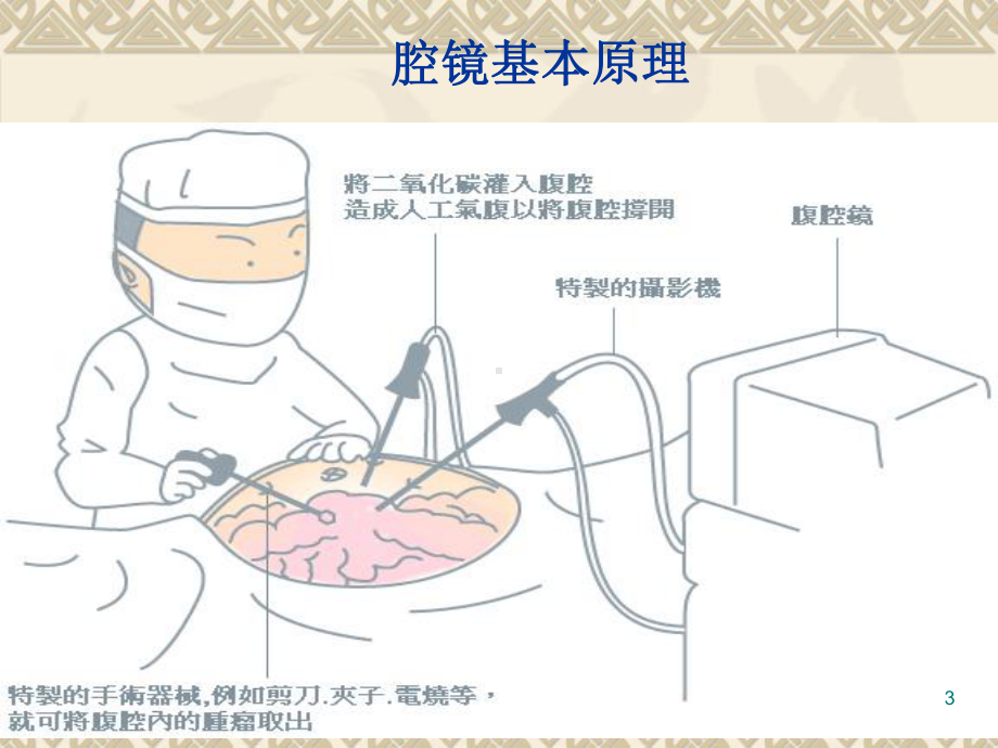 腹腔镜下卵巢囊肿切除PPT课件.ppt_第3页