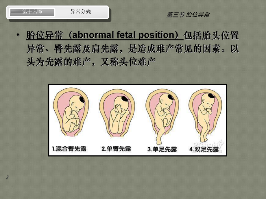 第八版妇产科配套课件-异常分娩-胎位异常.ppt_第2页