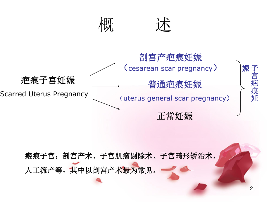 疤痕妊娠的影像学诊断PPT课件.ppt_第2页