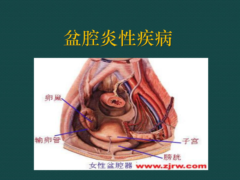 盆腔炎-最新PPT课件.ppt_第1页