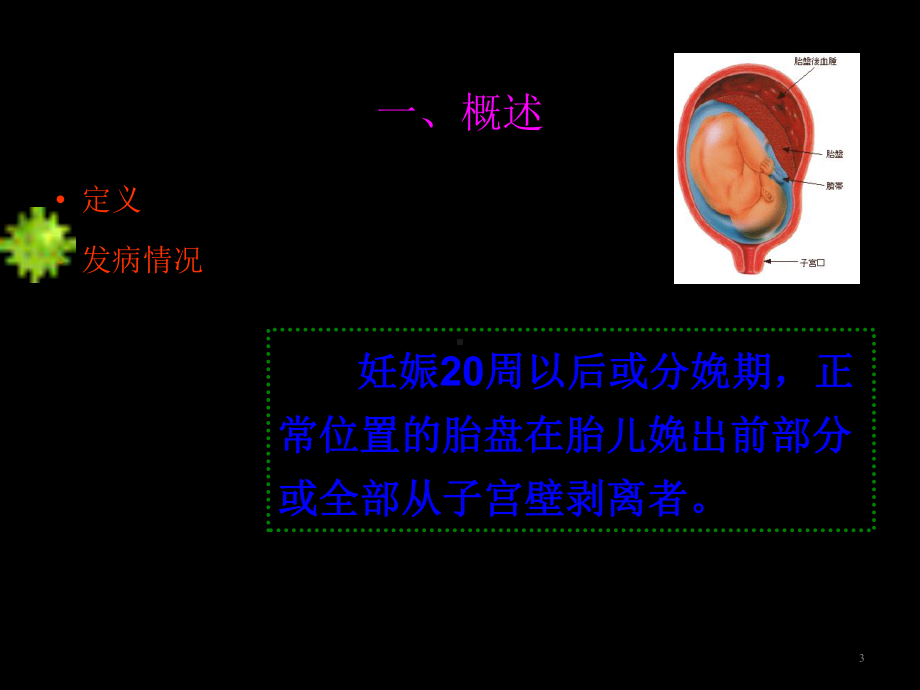 胎盘早剥护理ppt课件.ppt_第3页