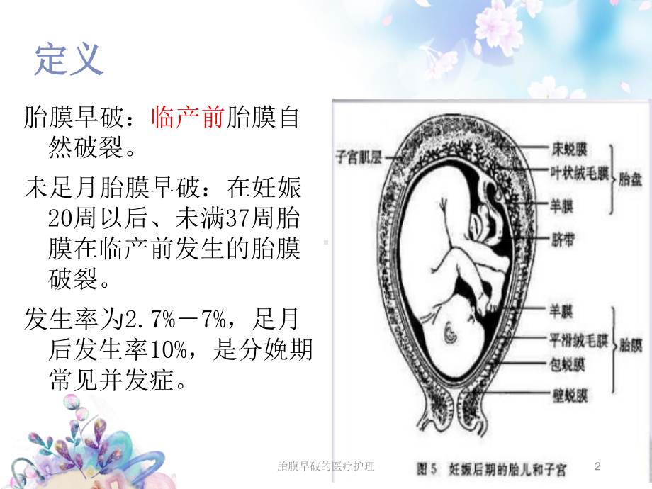 胎膜早破的医疗护理培训课件.ppt_第2页