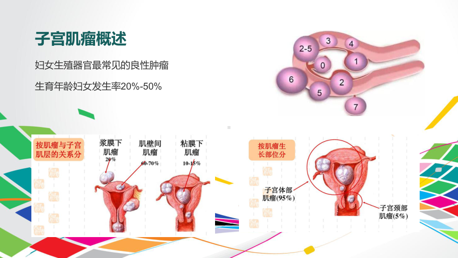 腹腔镜下特殊部位子宫肌瘤剔除术-ppt课件.ppt_第2页