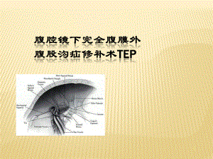 腹腔镜下完全腹膜外腹股沟疝修补术PPT课件.pptx