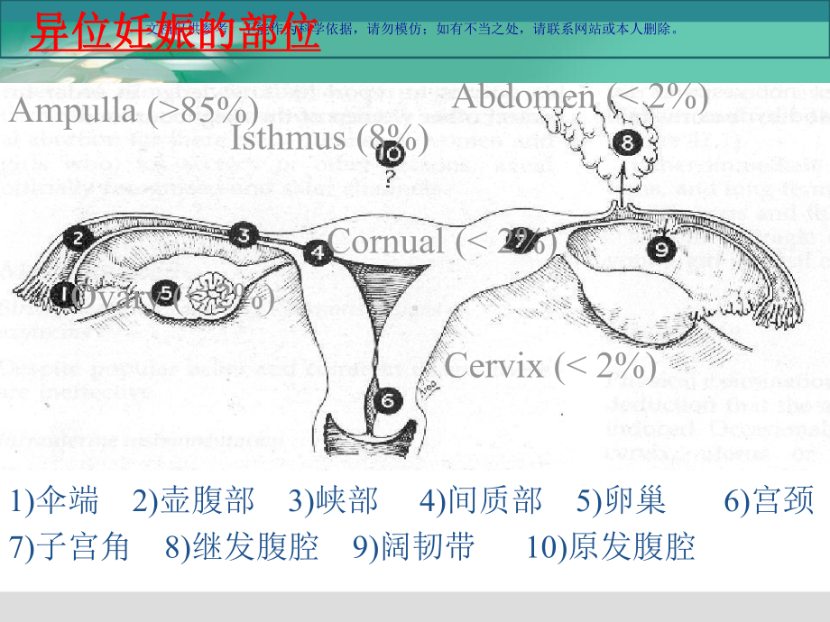 腹腔镜下宫外孕手术的医疗护理配合课件.ppt_第3页