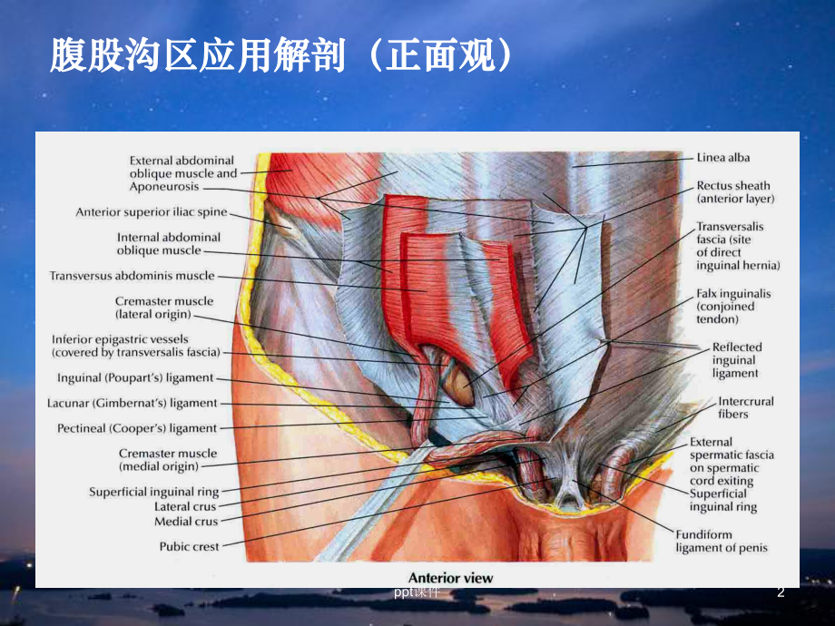 腹腔镜腹股沟疝修补术课件.ppt_第2页