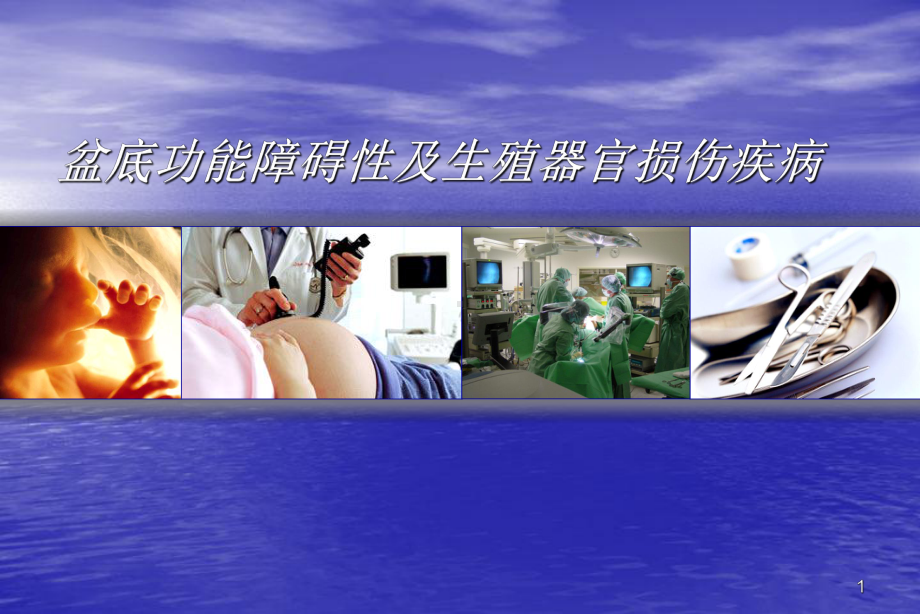 盆腔脏器脱垂ppt课件.ppt_第1页