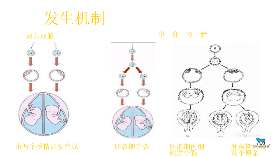 联体双胎的超声诊断课件.ppt_第3页