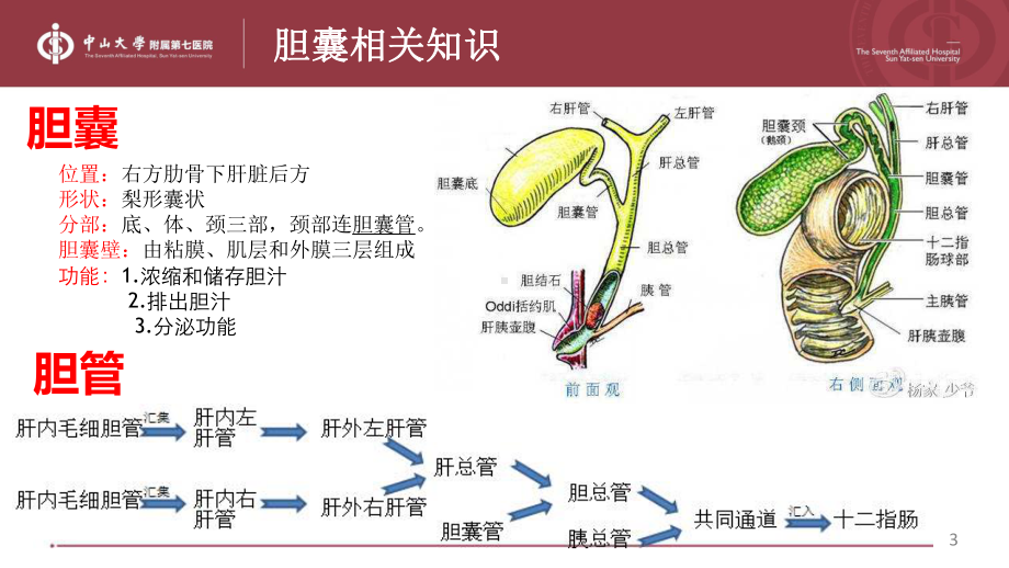 腹腔镜下胆囊切除术护理PPT课件.ppt_第3页