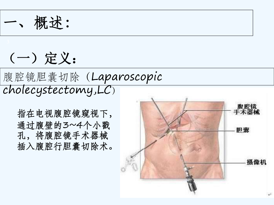 腹腔镜胆囊切除术后病人护理-PPT课件.ppt_第3页