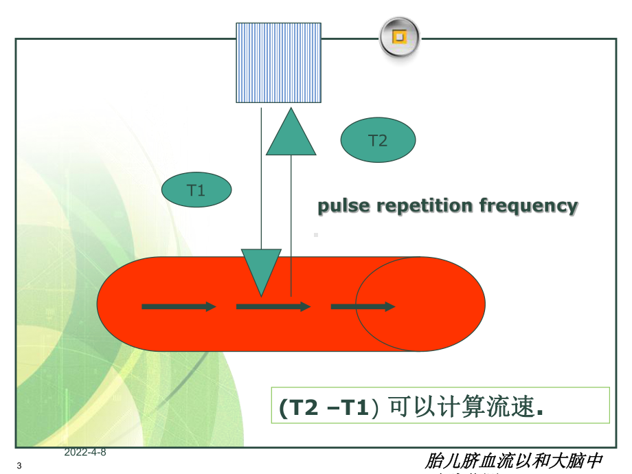 胎儿脐血流以和大脑中动脉监测培训课件.ppt_第3页