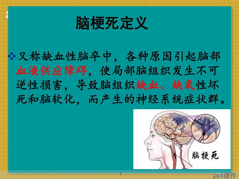 脑梗死溶栓护理-ppt课件.ppt_第3页