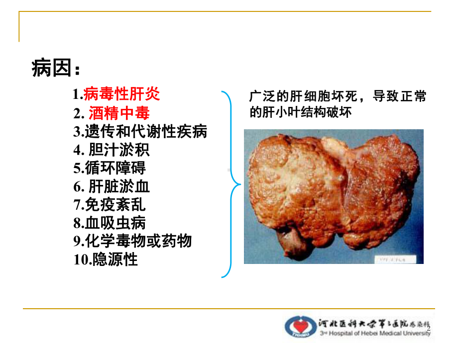 肝纤维化新进展PPT课件.ppt_第2页