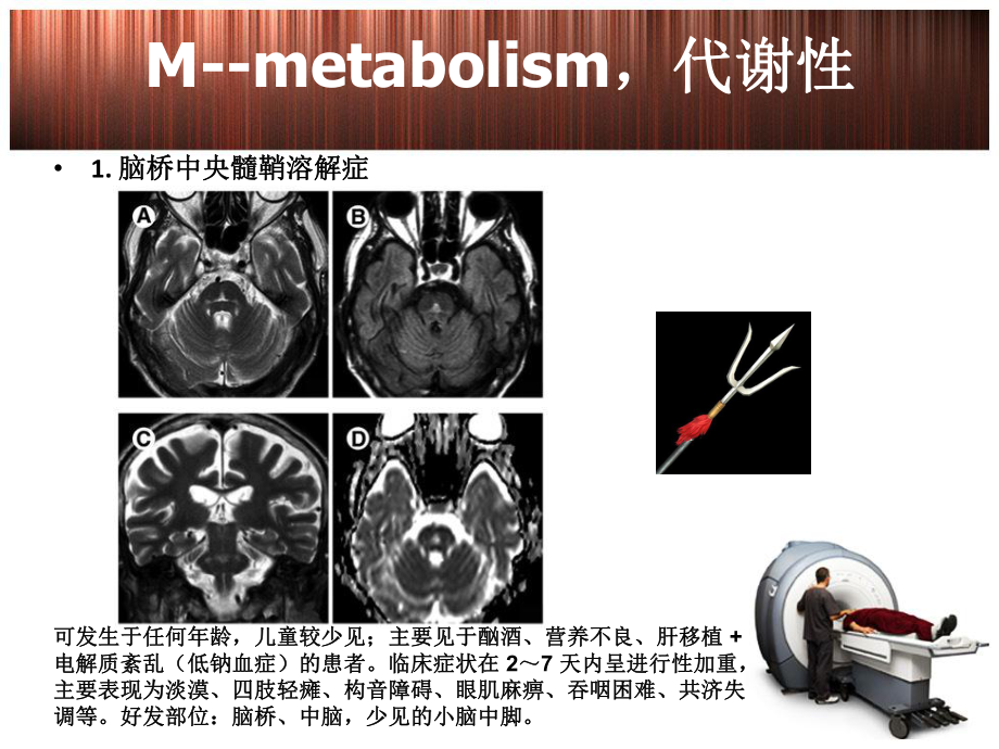 脑干病变的影像诊断课件.ppt_第3页