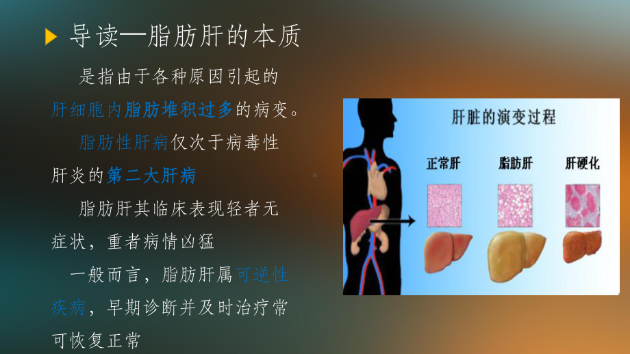 脂肪肝案例分析ppt课件.ppt_第2页