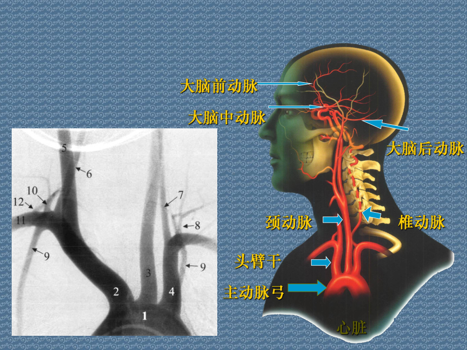 脑血管造影阅片基础解读课件.ppt_第2页