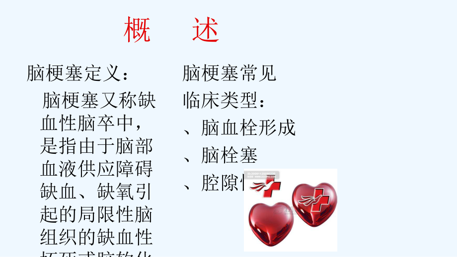 脑梗塞护理常规课件.ppt_第3页