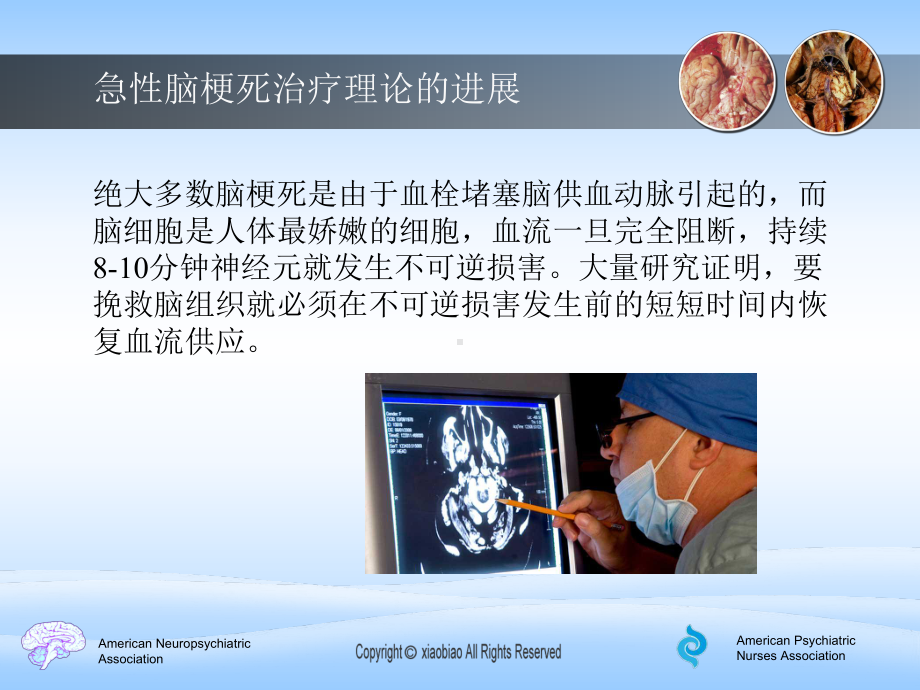 急性脑梗标准治疗死[新版]课件.ppt_第3页