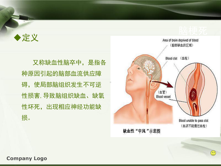 脑梗死诊治规范.课件.ppt_第3页