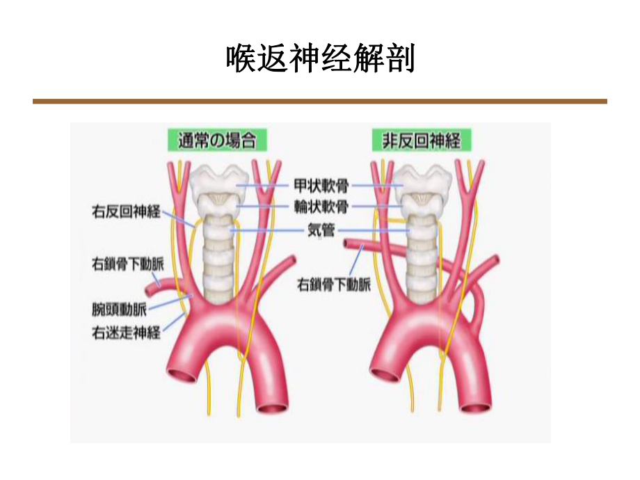 喉返神经解剖技术外科进展课件.ppt_第2页