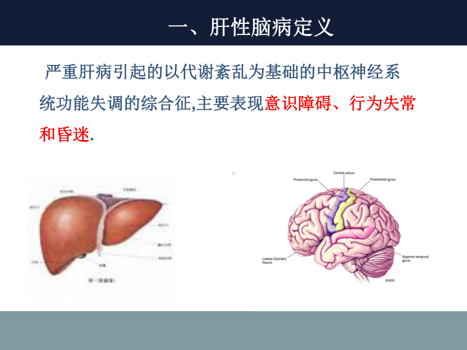 肝性脑病课件.ppt_第3页